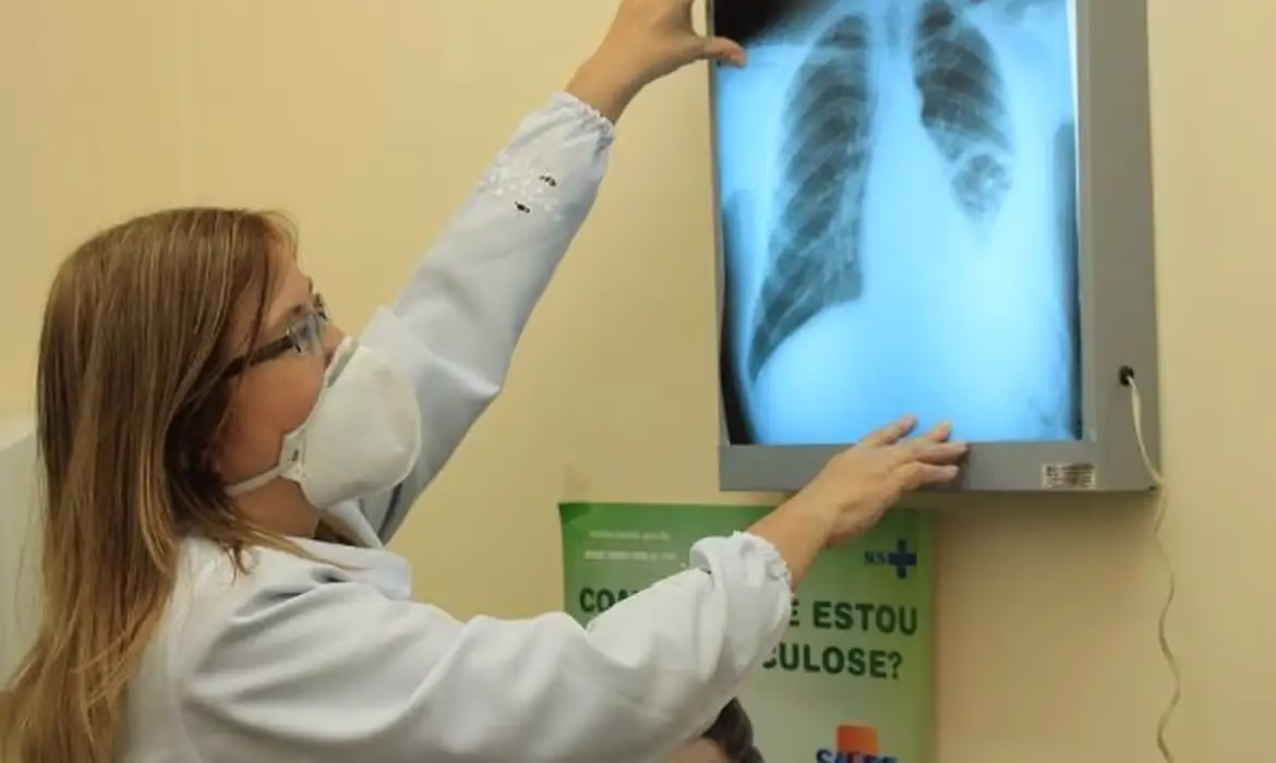 Baixo financiamento mundial ameaça combate à tuberculose