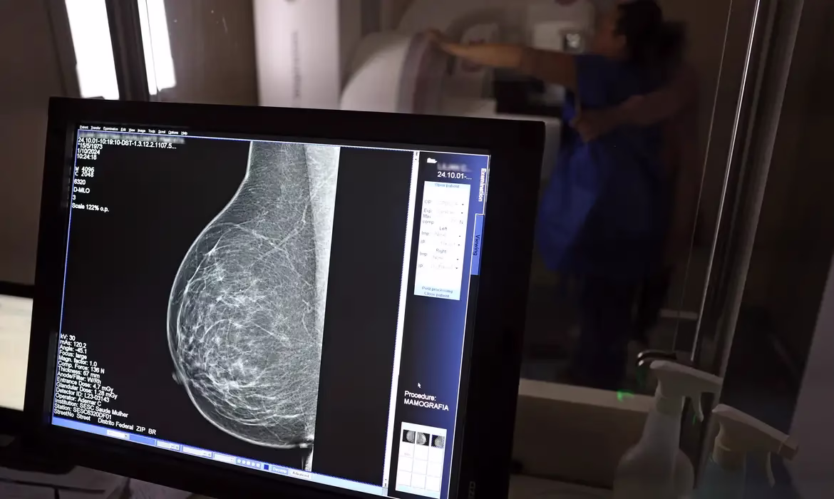 Câncer de mama: uma em cada três pacientes tem menos de 50 anos